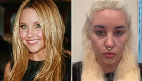 what happened to amanda bynes eyebrows|amanda bynes bleph surgery.